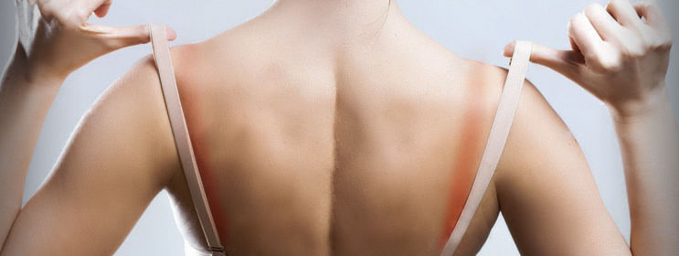 Getting rid of bra strap marks… Bra strap marks are so easy to get