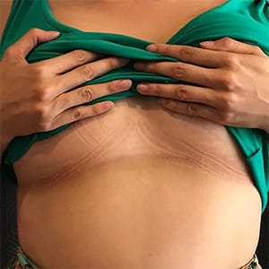Why Does My Sports Bra Hurt My Ribs?