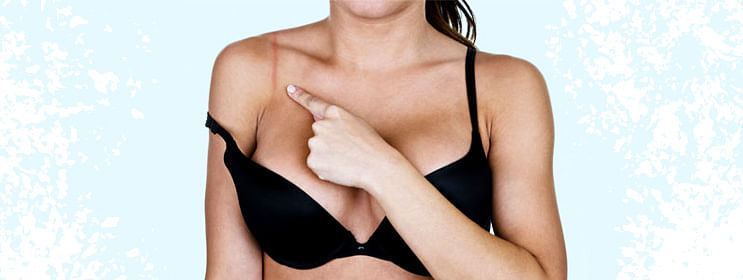 Does wearing a tight bra will cause health problems in the long
