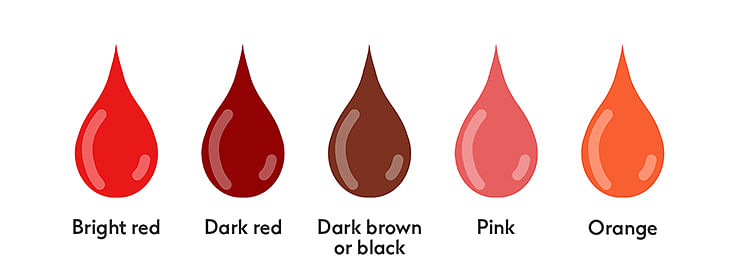 Healthy period blood typically varies from bright red to dark brown or  black. Blood or discharge that is of a darker shades indicates a c
